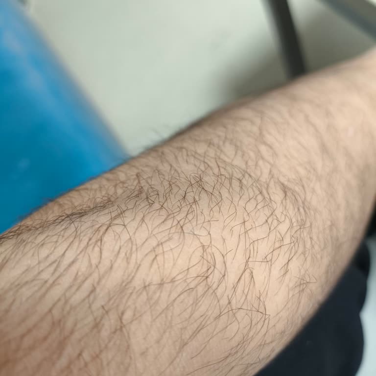 Perla Vista Güzellik Merkezi Fiyaskosu