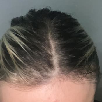 The Rise Hair Lounge Göztepe Röfle Memnuniyetsizliği!