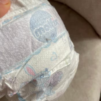 Molfix Bezin İçinden Çıkan Plastik İğne Gibi Bir Şey!