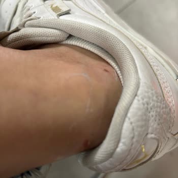 SuperStep Adidas Ayakkabı Mağduriyeti! İade İstiyorum