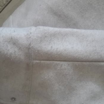 Zara Gömlek 5 Ayda Tüylendi