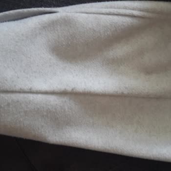 Zara Gömlek 5 Ayda Tüylendi