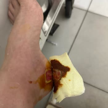 Aile Sağlığı Merkezleri Kapaklı Atatürk Aile Sağlık Birimine Ayağımdaki Rahatsızlık Sebebiyle