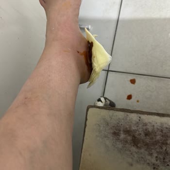 Aile Sağlığı Merkezleri Kapaklı Atatürk Aile Sağlık Birimine Ayağımdaki Rahatsızlık Sebebiyle