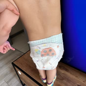 Prima Premium Care Bezlerinde Beklenmedik Sarkma Problemi