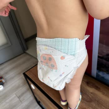 Prima Premium Care Bezlerinde Beklenmedik Sarkma Problemi