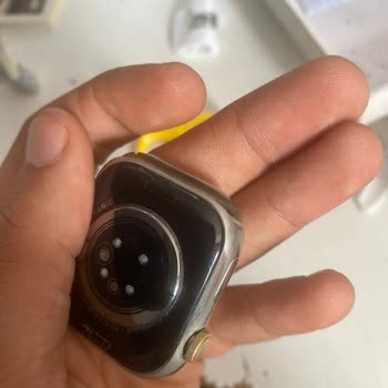 Trendyol Fails to Resolve My Discolored Watch Issue