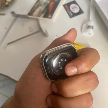 Trendyol Fails to Resolve My Discolored Watch Issue