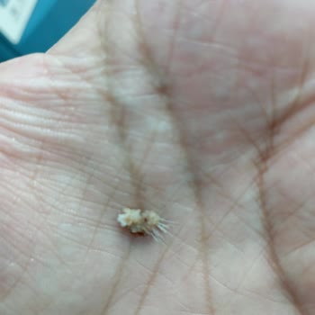 İstanbul Deposite AVM Köfteci Yusuf Et Dönerden Killi Et Parçası Çıktı