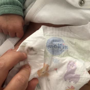 Molfix Bebek Bezinde Bilinmeyen Siyah Bir Şeyler Çıktı
