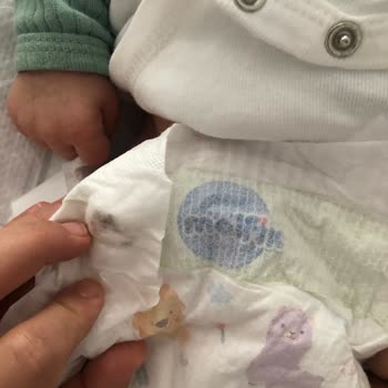 Molfix Bebek Bezinde Bilinmeyen Siyah Bir Şeyler Çıktı
