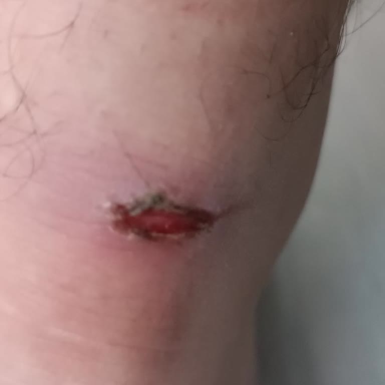 Lumberjack Ayakkabı Arka Vurması