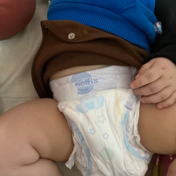 Molfix 4 Numara Bebek Bezi Pişik Yaptı