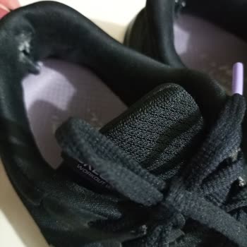Skechers Ayakkabının Sekiz Aylık Ömrü Ve Sözde İnceleme İşlemleri...