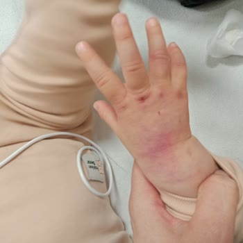 Pamukkale Üniversitesi Hastanesi Hastanede Tedavi Sürecinde Yaşanan Sorumsuzluk Ve İlgisizlik