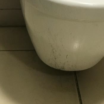 Özel Erciyes Hastanesi Kayseri Erciyes Hastanesi Hakkında