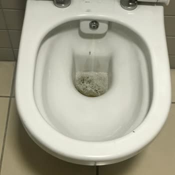 Özel Erciyes Hastanesi Kayseri Erciyes Hastanesi Hakkında
