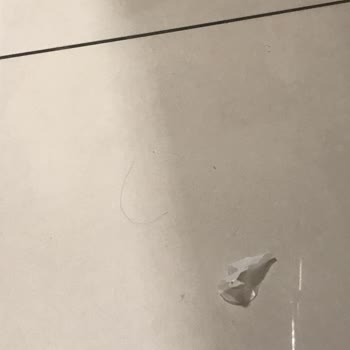 Özel Erciyes Hastanesi Kayseri Erciyes Hastanesi Hakkında