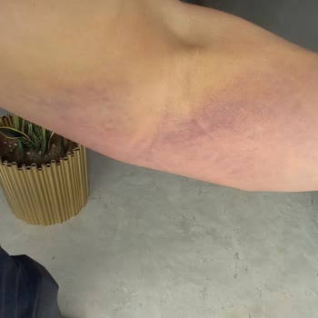 Medical Park Hastanesi Göztepe Kan Alma Morarma Sorunu