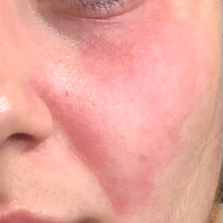 Bioderma Yüz Yıkama Jeli