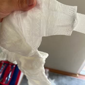 Baby Turco Bebek Bezi Cırtcırt Sorunu