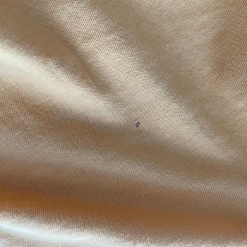 Arçelik Çamaşır Makinesi Çamaşırları Deliyor, Servis İlgilenmiyor