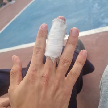 EyüpSultan Belediyesi Basketbol Sahalarının Eskimesi