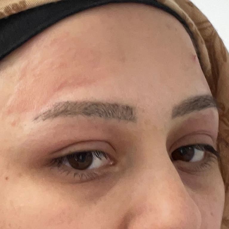 Golden Rose Alerji Yapan Pudra