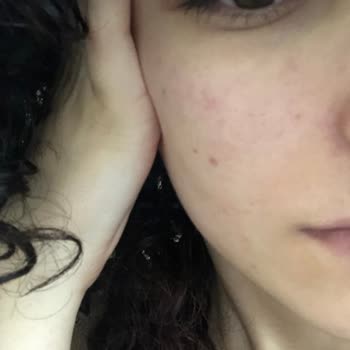 BİM Claderm Arındırıcı Kil Maskesi