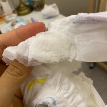 Molfix Bebek Bezinin İçinde Bilinmeyen Bir Madde