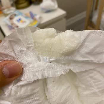 Molfix Bebek Bezinin İçinde Bilinmeyen Bir Madde