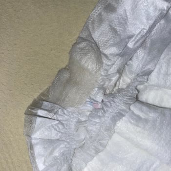 Molfix Bebek Bezinin İçinde Bilinmeyen Bir Madde