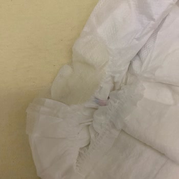 Molfix Bebek Bezinin İçinde Bilinmeyen Bir Madde