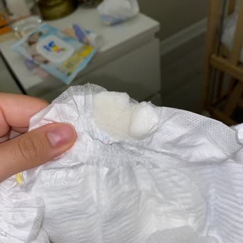 Molfix Bebek Bezinin İçinde Bilinmeyen Bir Madde