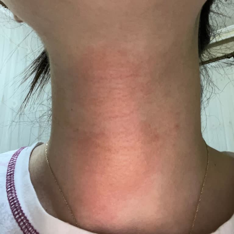 Bargello Parfüm Tenimi Tahriş Etti