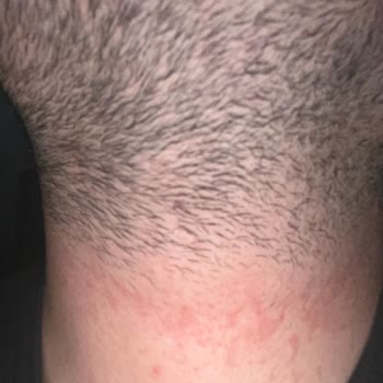 Bargello Parfüm Tenimi Tahriş Etti