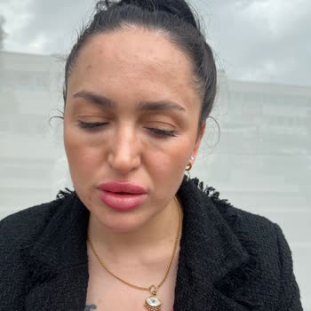 Sena Medikal Estetik Gözaltı Işık Dolgusu Sorunu