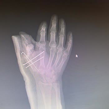 MACFit (İstanbul Avrupa) Umarım Macfit'e Üye Olurken Bir Daha Düşünürsünüz.