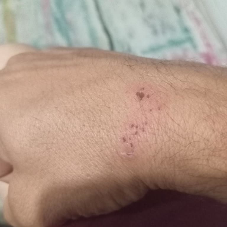 Antalya Büyükşehir Belediyesi Antalya Sivrisinek Acil Çözüm