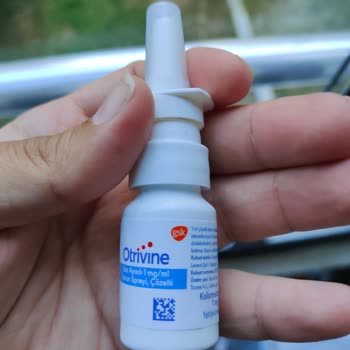 Otrivine İncelenmeli Eğer Hata Varsa Kaynağı Dibine Kadar İncelenmeli