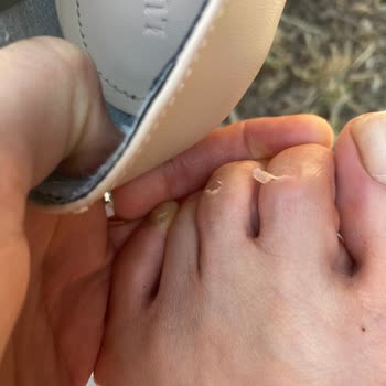Lutvelizade Sivri Burun Üç Bantlı Babet Mağduru