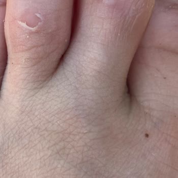 Lutvelizade Sivri Burun Üç Bantlı Babet Mağduru