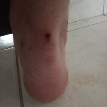 FLO Mağazasından Aldığım -Lumberjack ZILWA 4FX Siyah Erkek Sneaker Sorunu