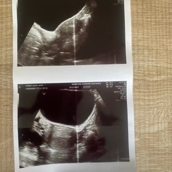 Ataşehir Medicana Kadın Doğum Teşhisi Hakkında