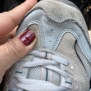 SPX Skechers Çözüm İstiyorum! Değişim Ya Da Paramı İade Edin!