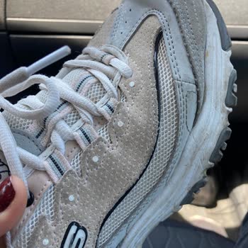 SPX Skechers Çözüm İstiyorum! Değişim Ya Da Paramı İade Edin!