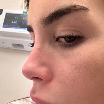 Migros Raf Düzeni İhmali Burnuma Ve Başıma Hasar Verdi