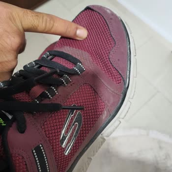 Skechers İlgisizliği Ve Kalitesizliği