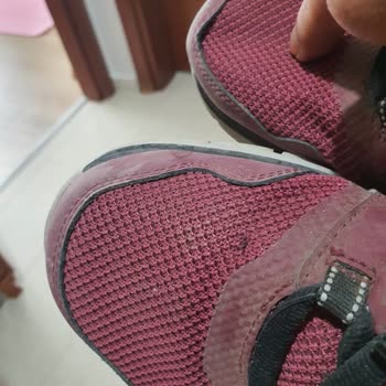Skechers İlgisizliği Ve Kalitesizliği