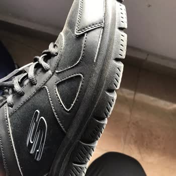 Skechers Markasının Adına Yakışmayan Ayakkabılar